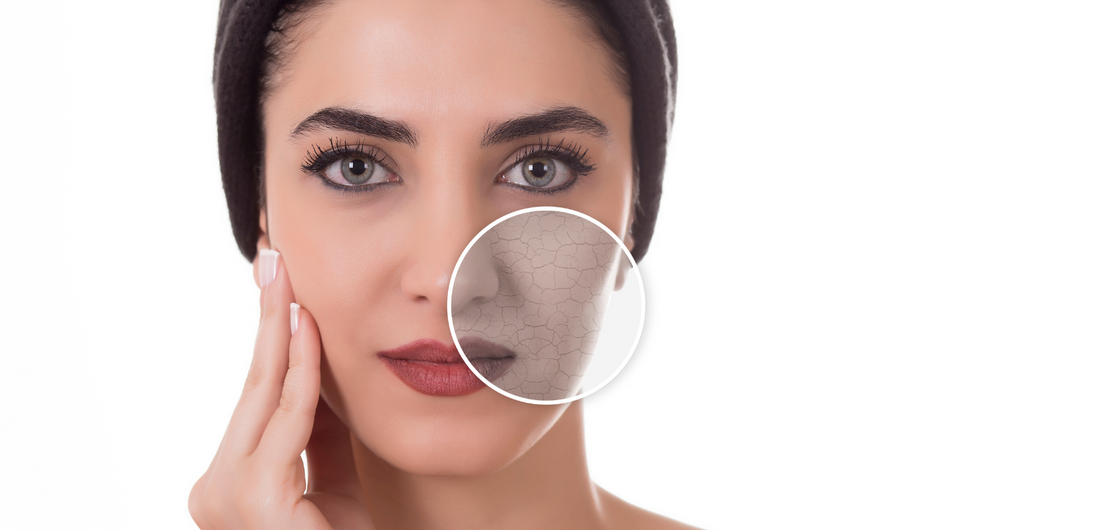 How to Get Rid of Skin Dryness in Summer