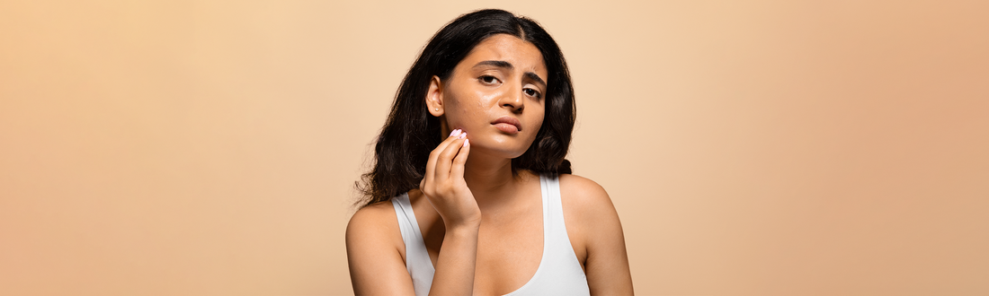 Oily Skin Causes & Skincare Routine