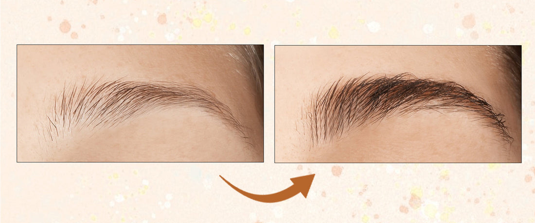 How to Grow Eyebrows Fast? 6 Easy Hacks