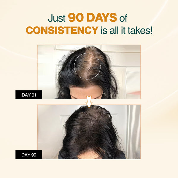 Advanced Hair Growth Serum with Rosemary Extract