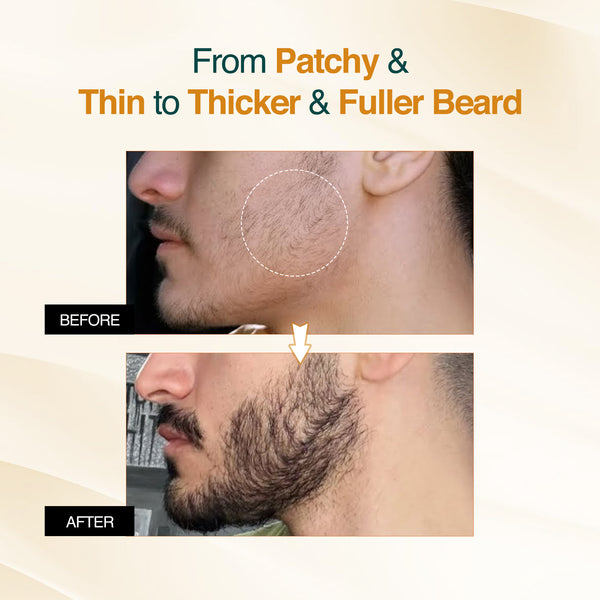 Advanced Beard Growth Oil Serum