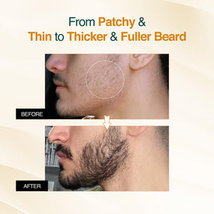 Advanced Beard Growth Oil Serum